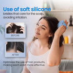 Hair Scalp Massager Shampoo Brush Scalp Exfoliator for Dandruff Removal for Hair Growth Wet Dry Scalp Exfoliator Brush - AliE